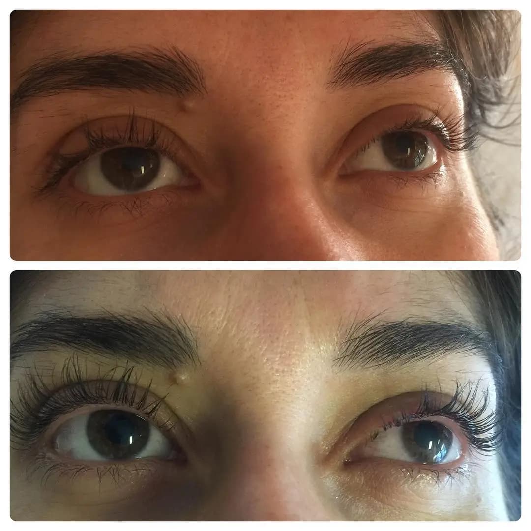 Lash Lift — Case 2 — Before and After